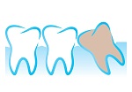 Wisdom Teeth in Richmond Hill