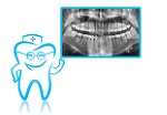 Dental Xray in Richmond Hill